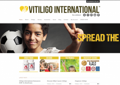 Vitiligo International